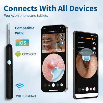 EarCleaner™ Earwax Removal Kit